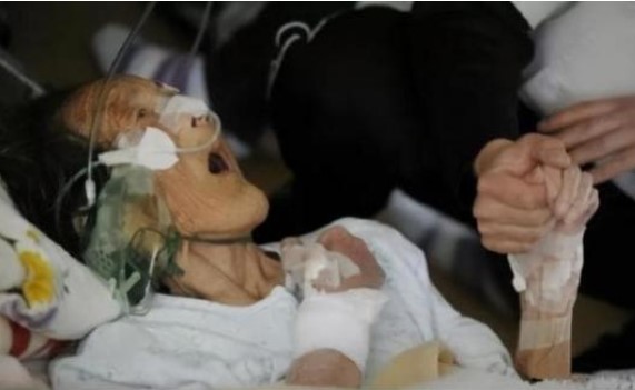 Tại sao người già luôn nói những điều 'vô nghĩa' trước khi chết? Chuyên gia: Đó không phải chuyện vớ vẩn