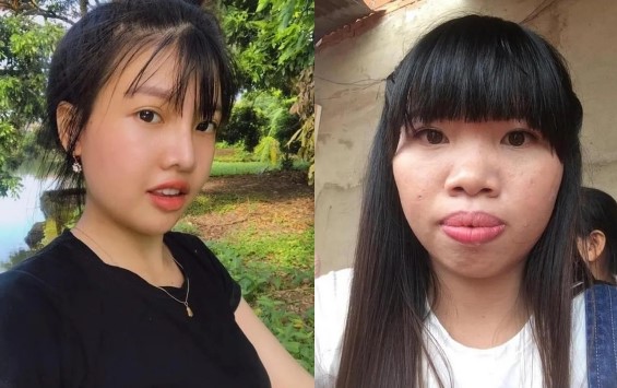 Từng đập mặt đi xây lại, 'Thị Nở tái sinh' hình ảnh hiện tại gây ngỡ ngàng