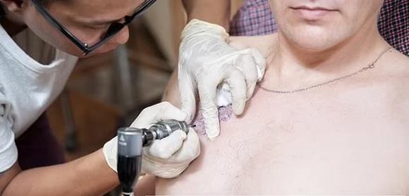 Sau 19 năm chung sống, vợ bắt quả tang bằng chứng ngoại tình của chồng chỉ nhờ chi tiết này trên cơ thể