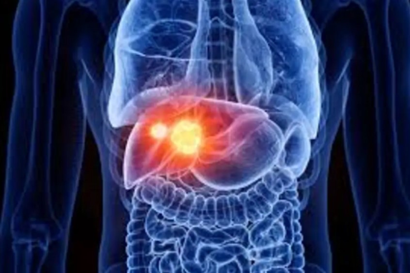 Nghiên cứu mới: Vaccine Geneos giúp thu nhỏ khối u gan