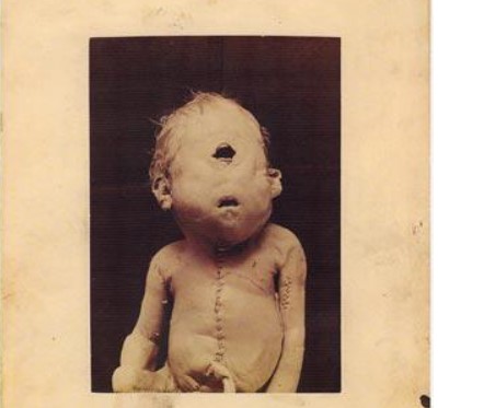 8 hi&#x1EC7;n t&#x1B0;&#x1EE3;ng &#x27;qu&#xE1;i d&#x1ECB;&#x27; nh&#x1EA5;t th&#x1EBF; gi&#x1EDB;i &#x111;&#x1B0;&#x1EE3;c l&#x1B0;u gi&#x1EEF; trong l&#x1ECB;ch s&#x1EED; khi&#x1EBF;n gi&#x1EDB;i y h&#x1ECD;c &#x27;&#x111;au &#x111;&#x1EA7;u&#x27;