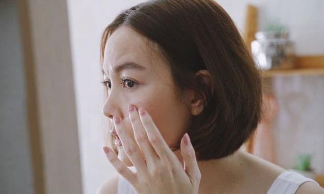 Cách ăn uống để giảm sẹo do mụn theo lời khuyên của phụ nữ Nhật Bản