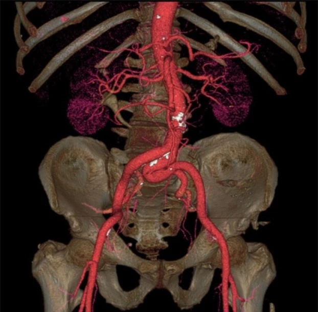   Động mạch chủ là động mạch lớn nhất trong cơ thể  