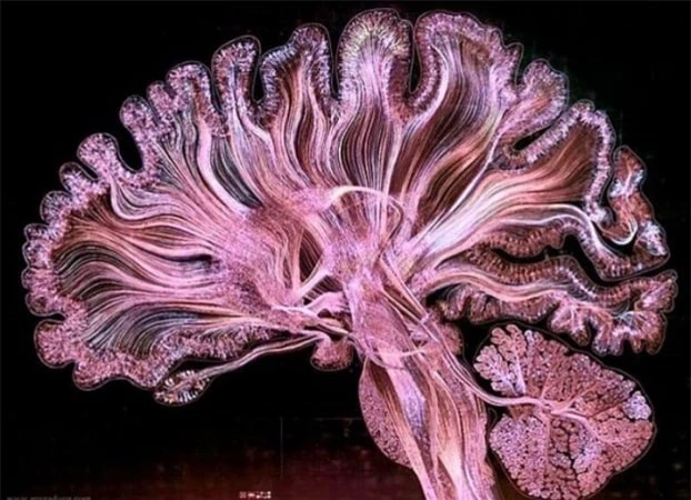   Ảnh chụp sọ não bằng phương pháp cộng hưởng từ khuếch tán  