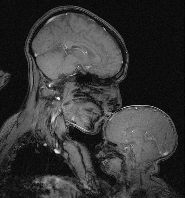   Ảnh chụp cộng hưởng từ một người phụ nữ và em bé  