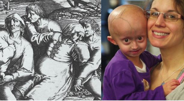 5 dấu hiệu 'báo động đỏ' ung thư buồng trứng