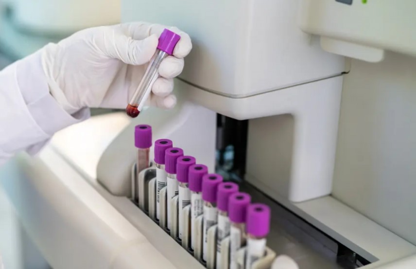 Đột phá AI: Phát hiện ung thư nhanh chỉ với một giọt máu