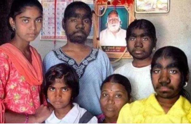 Ngôi làng duy nhất trên thế giới có hơn 200 người giống nhau y hệt, lý do đằng sau là ẩn số