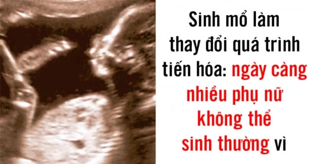 6 sự thay đổi ở cơ thể người cho thấy chúng ta vẫn đang tiến hóa 0