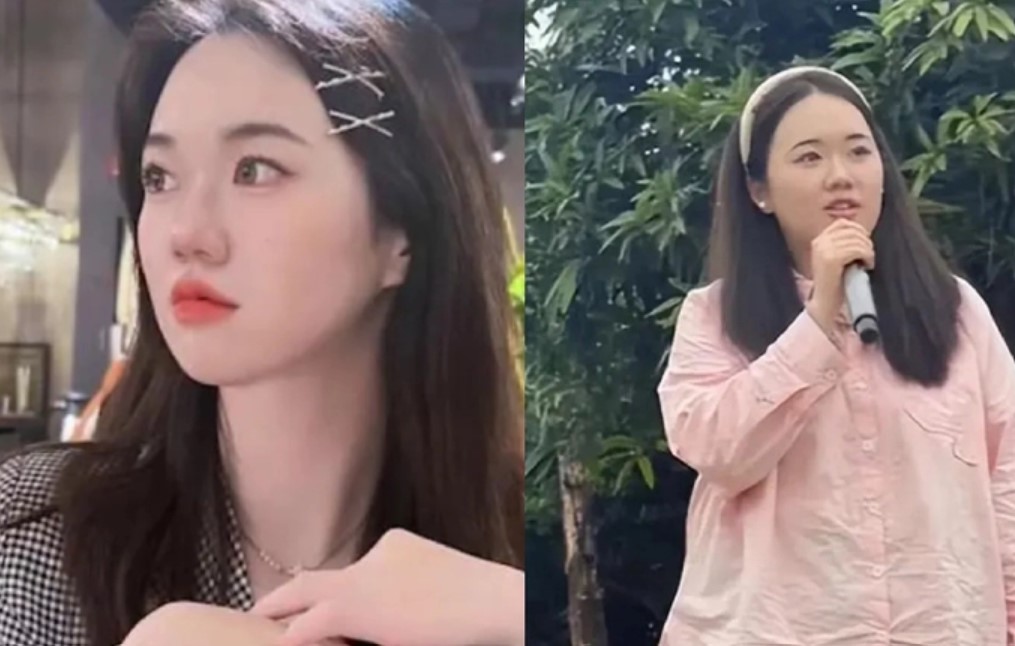 Cô gái tăng 40kg sau hơn 1 năm đi làm, từ xinh đẹp hóa xấu xí, tuổi 20 như 40