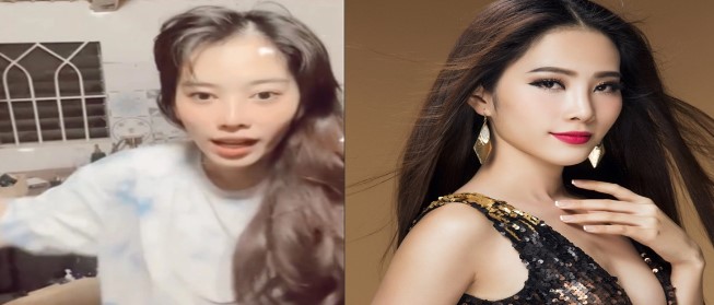 Nam Em xuất hiện với gương mặt gây choáng, thừa nhận bí mật khiến cho nhan sắc tuột dốc