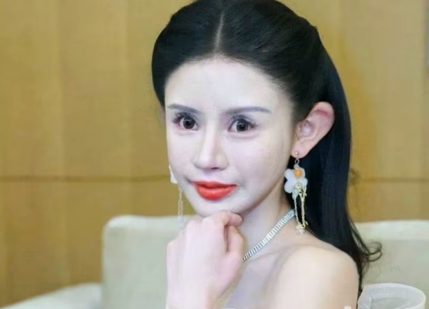 Nhan sắc khác lạ của hot girl Trung Quốc "nghiện" dao kéo từ năm 13 tuổi