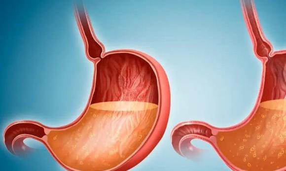 Trước khi ung thư dạ dày tấn công, cơ thể có thể gửi đi hai tín hiệu mà hầu hết mọi người có xu hướng bỏ qua