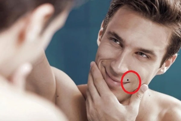 Tiết lộ bí mật cuộc đời đằng sau những nốt ruồi xấu trên cơ thể đàn ông