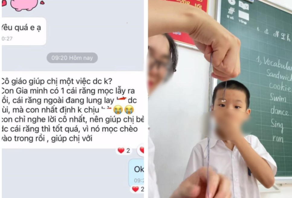 Đoạn tin nhắn mẹ nhờ cô giáo nhổ răng cho con khiến ai nấy phì cười, để ý 1 chi tiết, nhiều người "rụng tim" vì đáng yêu quá!