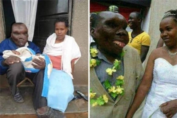 Baguma, Người đàn ông xấu xí nhất trên thế giới, ba vợ