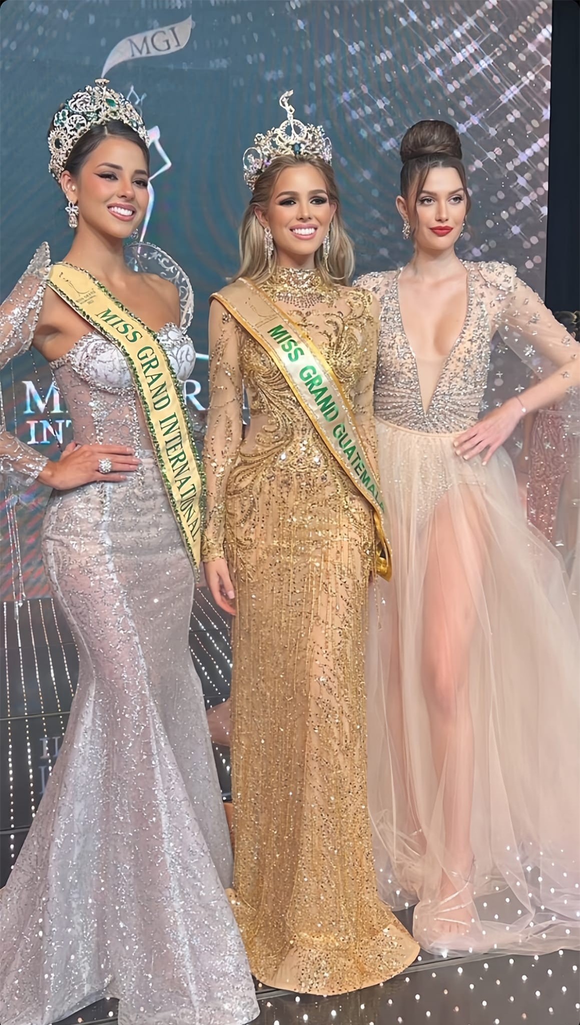 Tân Hoa hậu Hòa bình Guatemala bị chê già nua ảnh 1