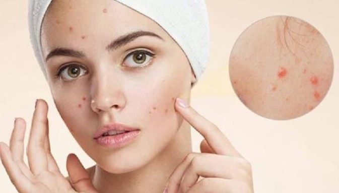 Phụ nữ 'rửa mặt' buổi sáng có nên dùng sữa rửa mặt? 60% mọi người rửa sai cách gây tổn thương cho da