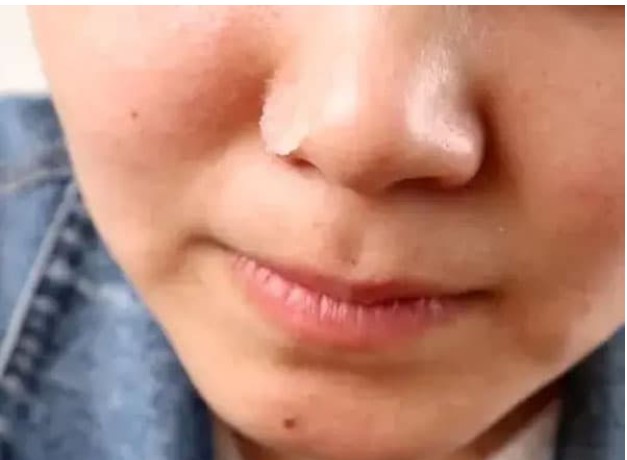 Xoa muối ăn lên mũi, hiệu quả quá, mỗi năm có thể tiết kiệm hàng trăm đô la, tiếc là tôi mới phát hiện ra, hãy xem thử!