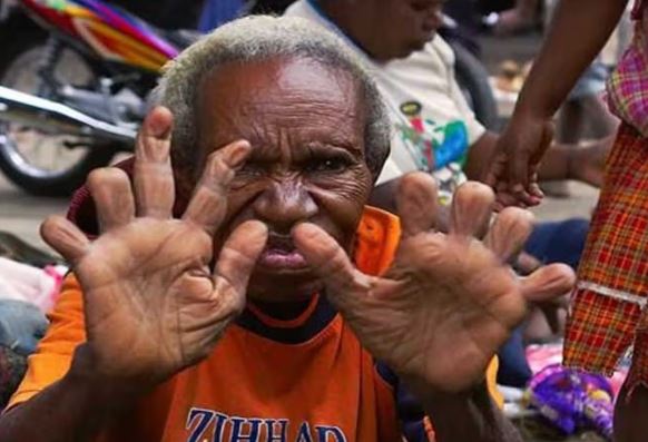 Bộ tộc có thủ tục rùng rợn: Phụ nữ phải cắt cụt ngón tay khi người nhà mất, càng thân thiết càng mất nhiều ngón!