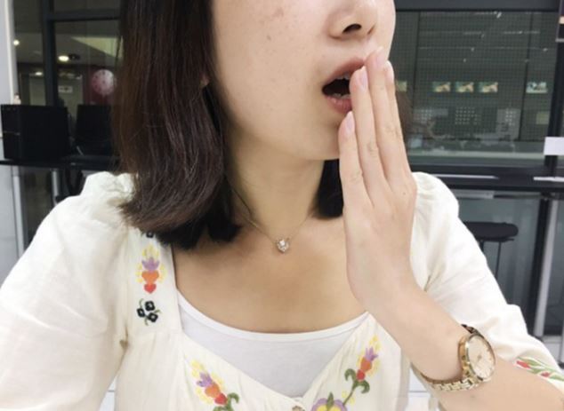 Chồng mất ăn mất ngủ vì mùi hôi miệng của vợ, đi khám mới hay cô mắc bệnh hiểm nghèo