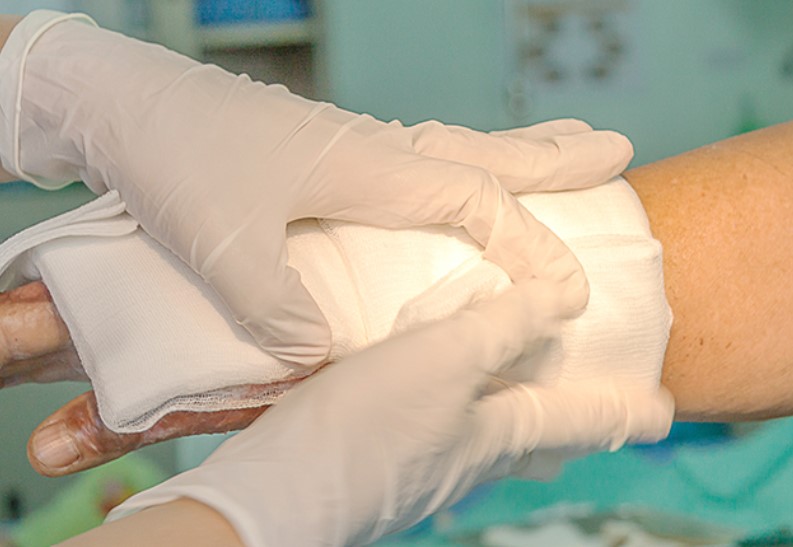 Điều trị vết bỏng bằng băng làm từ thực vật thân thiện với môi trường