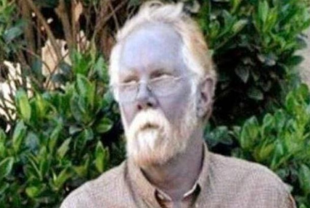 'Người da xanh' hiếm hoi trên thế giới sống ẩn dật trên đỉnh núi cao để tránh bị chỉ trích, cả trăm năm mới lộ diện một lần