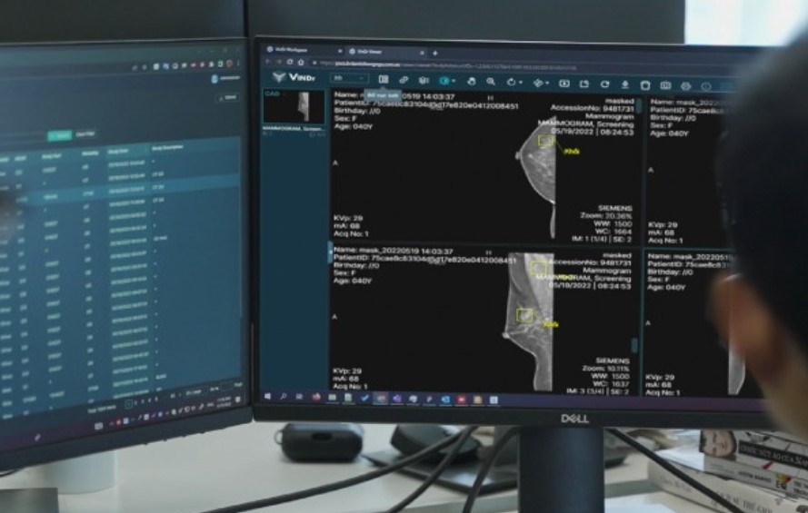 Công nghệ VinDr của Việt Nam chính thức được FDA cấp phép