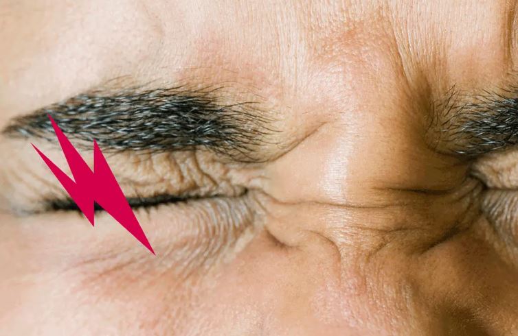 Chớp mắt bị đau là do đâu? Cẩn thận bị mất thị lực vĩnh viễn!