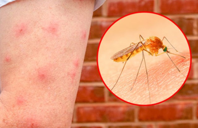 Tại sao tắt điện thì muỗi kêu vo ve, bật điện lên lại không tìm thấy?