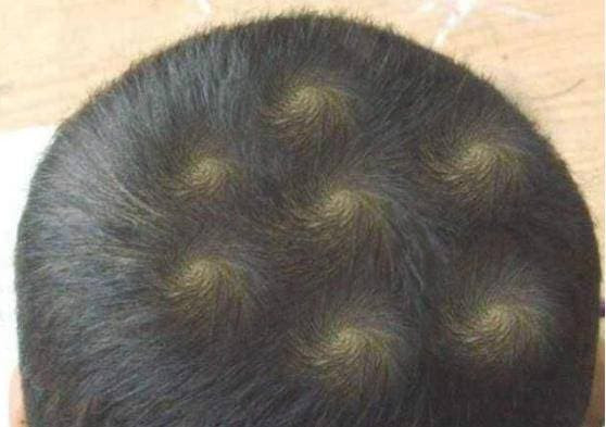 Số lượng 'xoáy' trên đầu cho biết tính cách của đứa trẻ? Các bố mẹ xem xong rồi sẽ biết nhé!