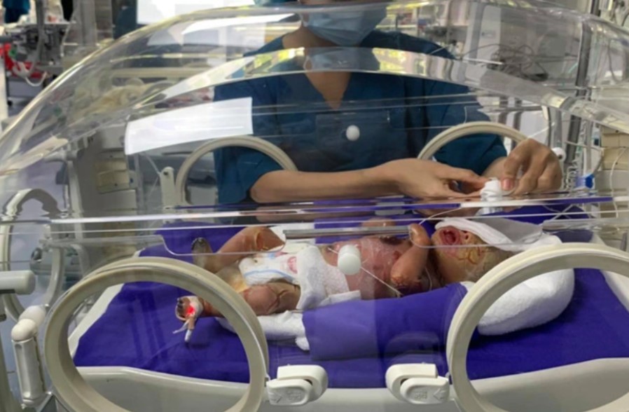 Giải mã gene giúp trị bệnh vảy cá, giải pháp điều trị dựa trên đặc điểm di truyền