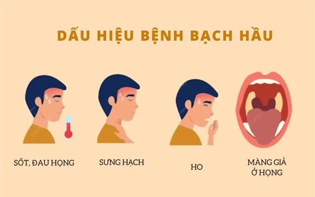 Dấu hiệu bị bệnh bạch hầu và cách phân biệt bệnh bạch hầu với viêm họng- Ảnh 2.