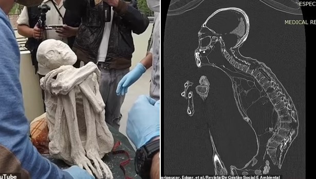 Tiết lộ mới về ‘xác ướp người ngoài hành tinh’ 3 ngón tay từng bị coi là lừa bịp