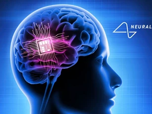 Chip não của Neuralink ở ca cấy ghép đầu tiên hoạt động tương đối ổn định