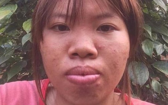 Nhan sắc của Phượng Thị Nở sau 7 năm 'đập đi xây lại' khiến ai cũng trầm trồ