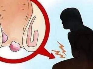 'Mười người đàn bà, chín người trĩ', phụ nữ nên tránh xa các bệnh về hậu môn trực tràng như thế nào?