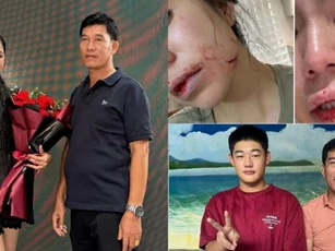 Bố Hằng Du Mục công khai giấy kiểm định sức khỏe của con gái sau khi bị Tôn Bằng bạo hành dã man