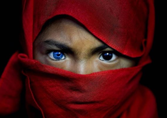 Bộ tộc sở hữu đôi mắt xanh như ngọc biếc, thế nhưng ẩn chứa phía sau lại là một căn bệnh hiếm gặp