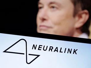 Neuralink đã lắp đặt thiết bị vi mạch vào não của bệnh nhân thứ hai