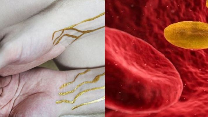 Nhóm máu quý hiếm nhất hành tinh: Cả thế giới chưa tới 50 người sở hữu,