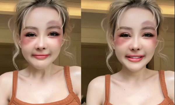 Netizen xôn xao khi thấy cảnh Ngân 98 bị Lương Bằng Quang ‘đánh’, mặt mày bầm tím