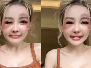 Netizen xôn xao khi thấy cảnh Ngân 98 bị Lương Bằng Quang ‘đánh’, mặt mày bầm tím