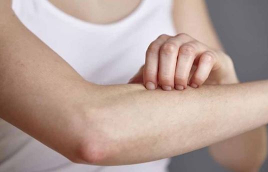 Vì sao sau khi bị muỗi đốt càng gãi càng ngứa?