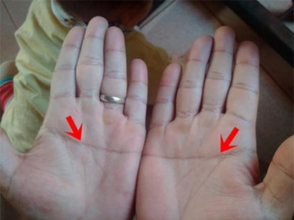 Cách Tính Tam Tai Trên Bàn Tay: Hướng Dẫn Đơn Giản Và Hiệu Quả Cho Mọi Tuổi