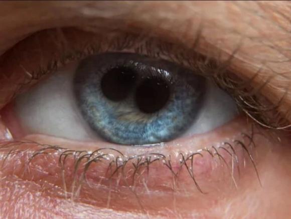 'Đồng tử kép' là gì? Trong lịch sử có 8 người có đôi mắt như vậy, họ đều là thánh nhân hoặc hoàng đế, Tần Thủy Hoàng cũng nằm trong số đó