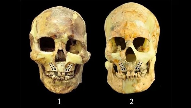 Kỳ lạ nghi thức nhổ răng để thử thách lòng dũng cảm