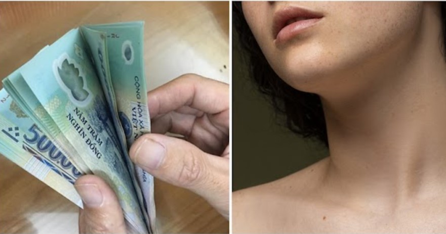 7 nốt ruồi là 'may mắn của kiếp người': Tuyệt đối đừng tẩy xóa