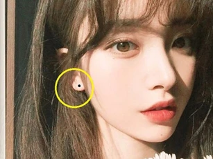 Top 10 nốt ruồi may mắn nhất trông như thế nào? Hãy xem bạn có được bao nhiêu?