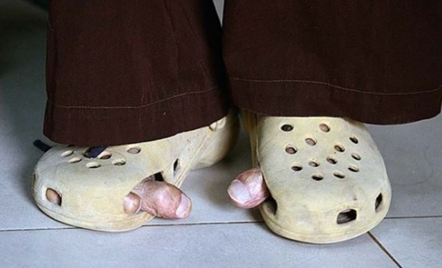 Bí mật bất ngờ về ‘bàn chân Giao chỉ’ của người Việt cổ: Cả nước chỉ còn rất ít người có đặc điểm này